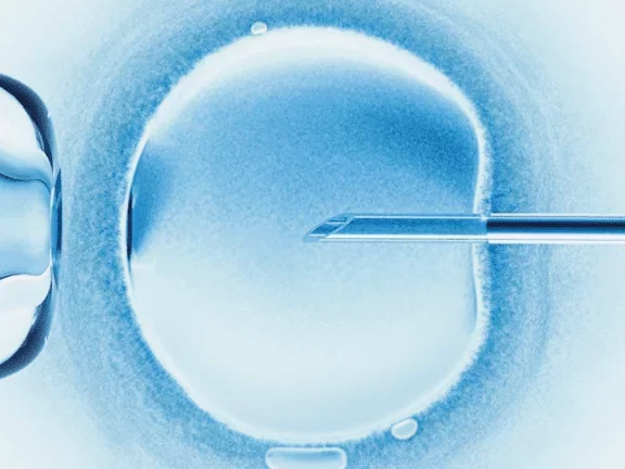 Fecundación in Vitro